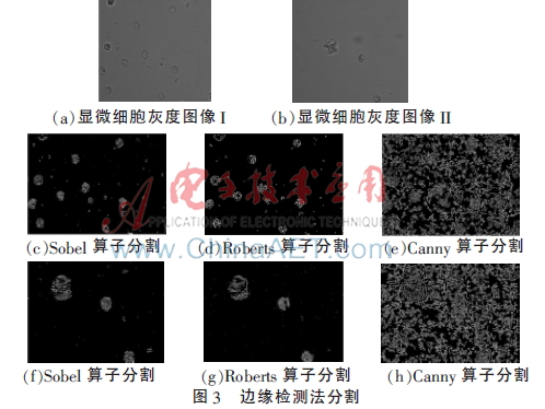 图像分割-图像处理_matlab图像分割代码_医学